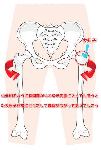 骨盤の開きの正体、内股、お尻の筋肉
